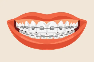 Bielaczyc Adam, dr nauk med. Spec. ortodonta Aparaty ortodontyczne